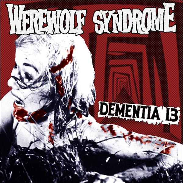 Werewolf Syndrome Photo