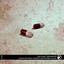 Euthanasia EP Albumcover