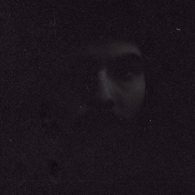 EUS photo