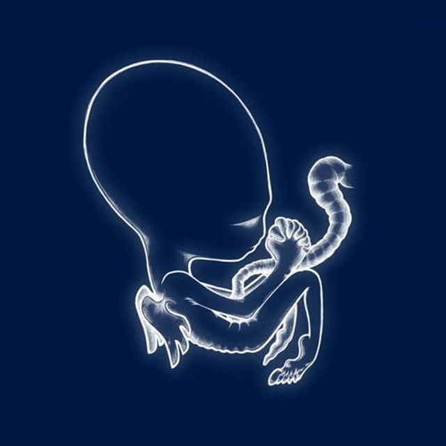 Ágætis Byrjun cover