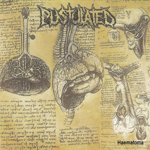 Haematoma cover