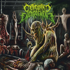 Cerebral Engorgement Photo