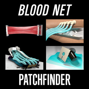 Patchfinder