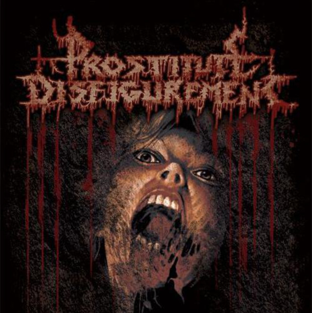 Prostitute Disfigurement photo