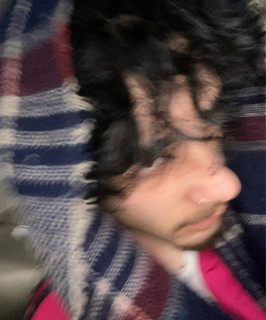 OXY