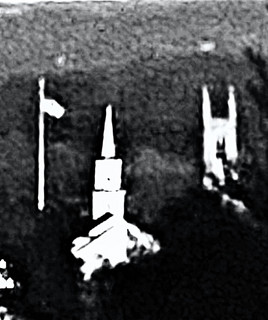 Sparko
