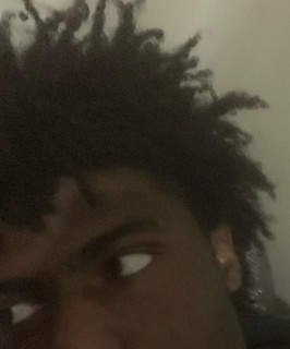 Hurt Emoji