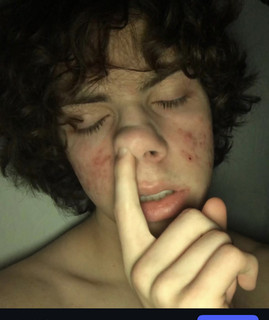 yoav