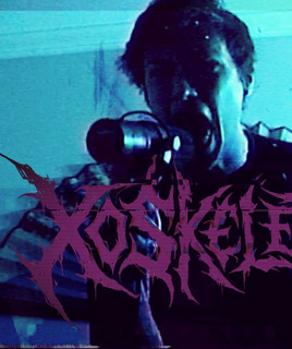 XOSkeletal