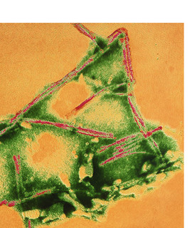Vilgot Photo
