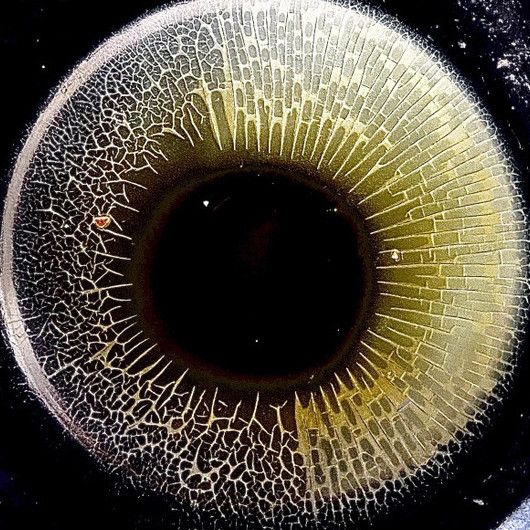 Dilate