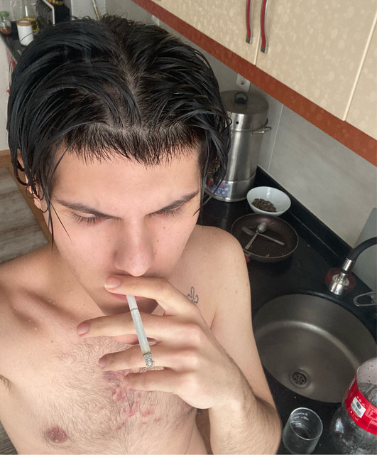 Kirpi