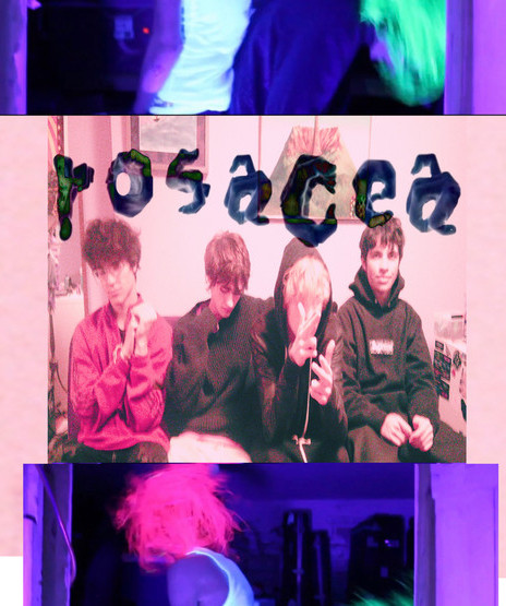 Rosacea boy