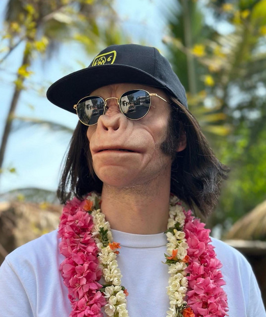 Kid Noize