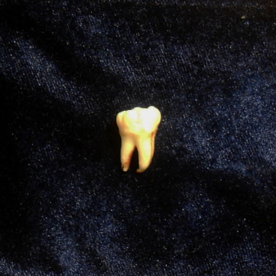Dentadura
