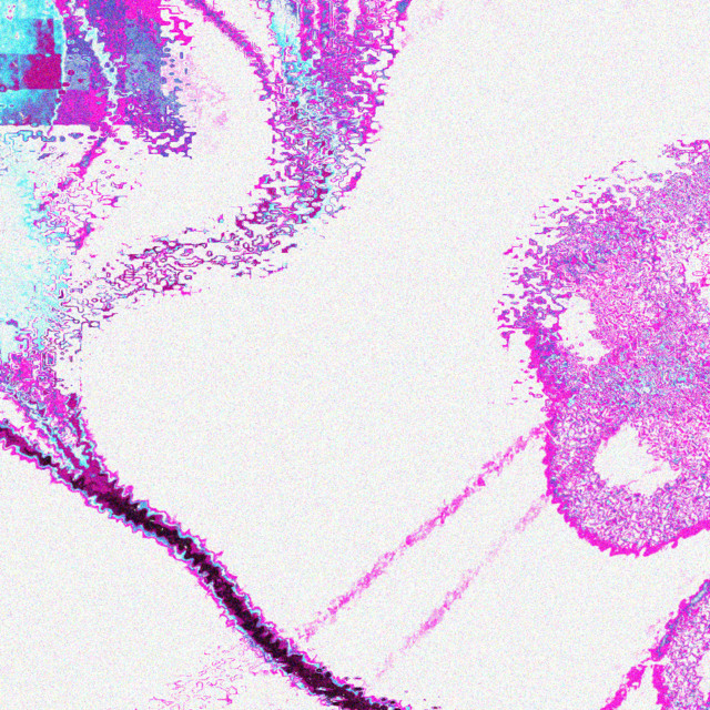 xevain