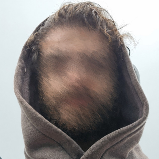 cloud_walker