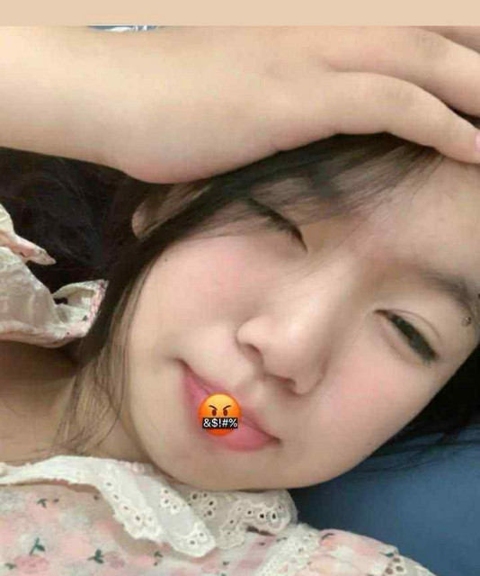 NHXS
