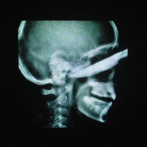 I CRUSHED THE HEAD OF THE SERPENT by 7xvn