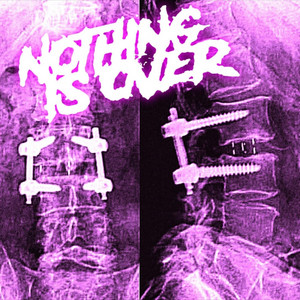 Nothing Is Over - Falling Again