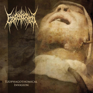 Ezophagothomical Invasion