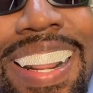 orios01 - Kanye's Teeth