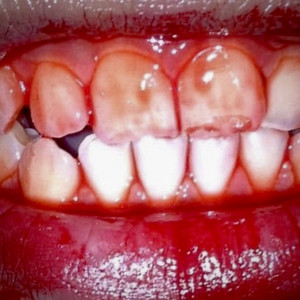 thirty two teeth by JUNKO SLEEZWELLE