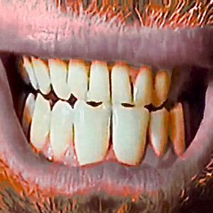 ULTRASONIC NERVOUSNESS by HIDEOUS BEAST