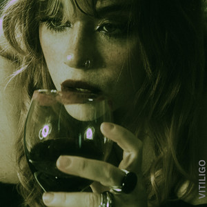 VITILIGO - CRUDELIA - I nervi