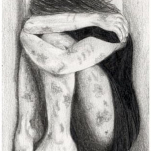 It's very Painful by Ferry Kurry