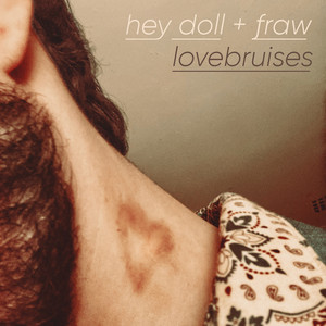 Lovebruises
