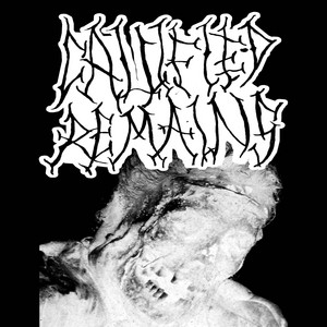 Calcified Remains - 1​.​Sanguinary Abreaction 2​.​Trazodone Paralysis 3. Amyotrophic Bodybuilder 4. Divalproex Malfunction 5. Manipulation of the Organs 6. Erupting Vascular Systems 7. Cystic Fibrous Tissue 8. Habitual Disintigregation 9. Trichotillomania 10. Fatal Elation