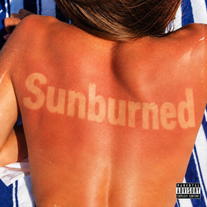 Sunburned
