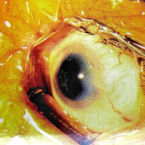 Drowning, Phone Calls