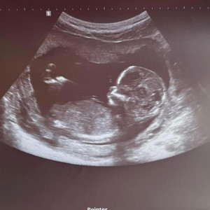 Jennie journey - GET ME PREGNANT