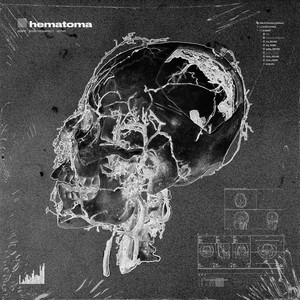 Hematoma by Misfit, do not resurrect