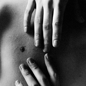 Inherited scars by KATIA POJIDAEVA