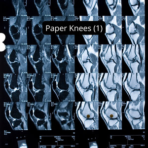 Paper Knees (1) by La Bella Emelyn