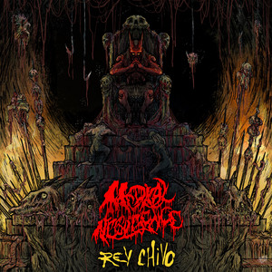 Rey Chivo by Medical Negligence