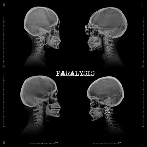 Paralysis by REMØRSE