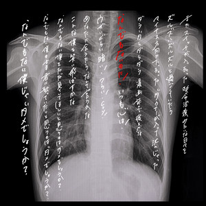 なんでもない (のに)