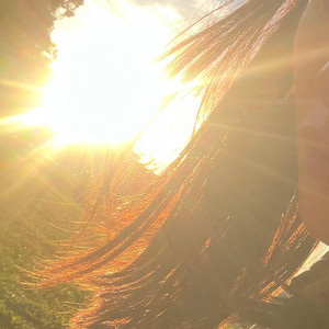 Sunburn by Marley Chaney