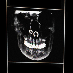 Virexey Torrent cover