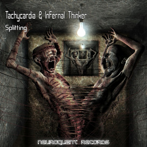Tachycardia — Splitting