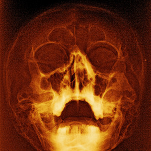 XRay by Teaching in Trips