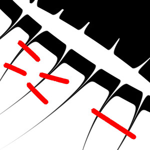 TEETH