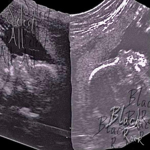 Black Rock by Select All