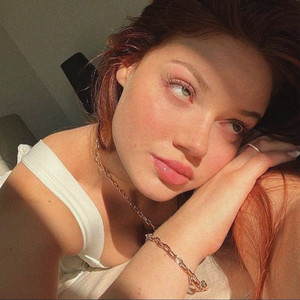 Sunkissed - My Stupid Heart - Acoustic