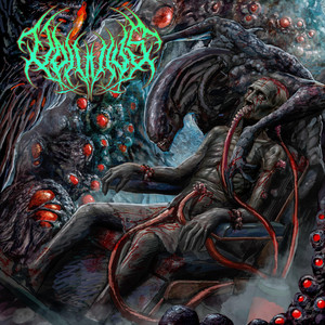 Volvulus Slam - Pablo's Interlude