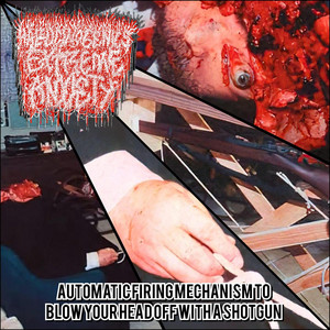 MIOCARDITIS CRONICA DILATADA TERMINAL - proyecto HxExA (A like this shit?cienporciento100Gorenoise no apto para oidos sensibles)